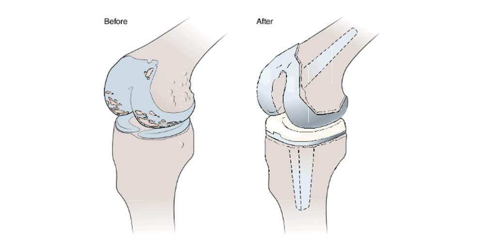 Figure 3.7_Knee Joint_Essentials of Special Populatons.png